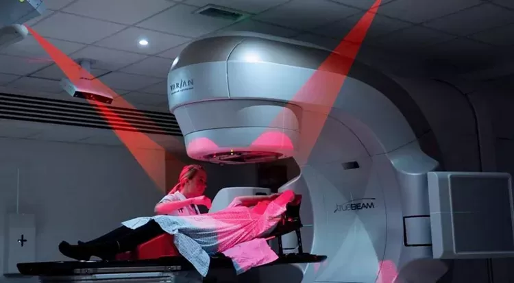 رادیوتراپی برای درمان کارسینوم سلول مرکل